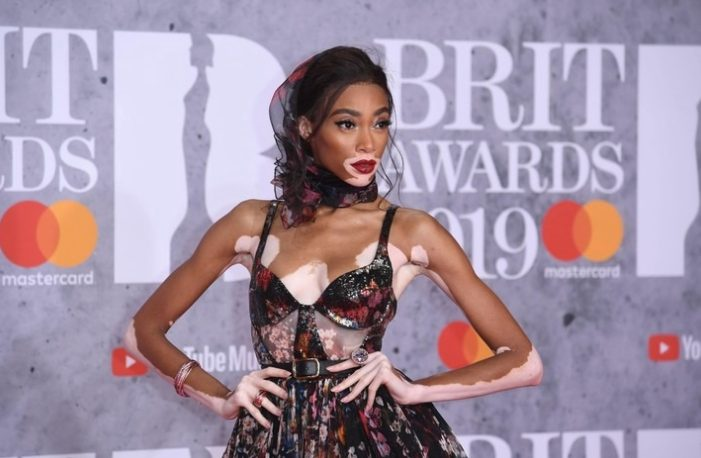 During her time on “America’s Next Top Model,” model scouts looked for Winnie Harlow, a beauty who became famous after being on the show.