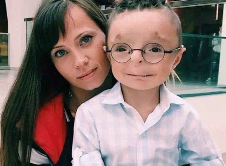 Woman adopts a boy no one wanted to adopt: see what he looks like now