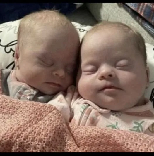 Mom of rare twins with Down syndrome shuts down critics with photo showing how beautiful they are