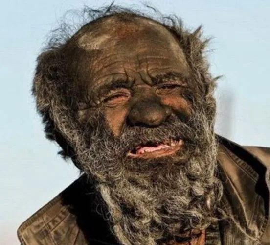 Meet the dirtiest man in the world who hasn’t showered in 67 years – his reason is amazing